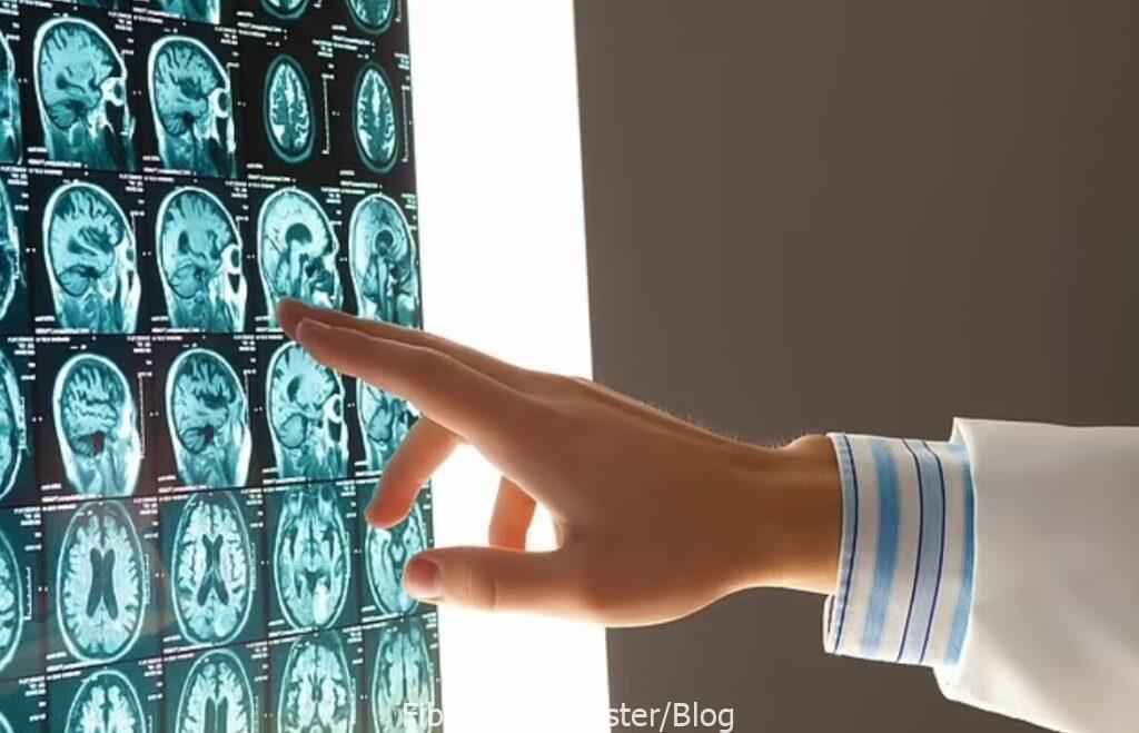 هوش مصنوعی ۹ نوع زوال عقل را با دقت ۸۸ درصدی تشخیص داد